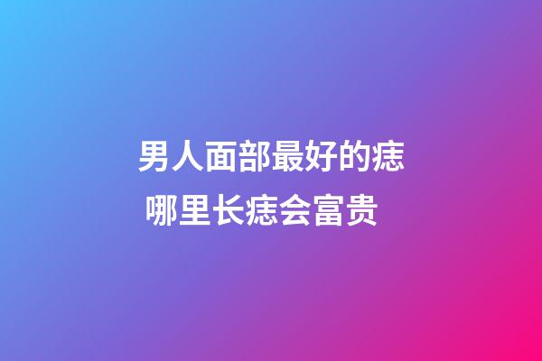 男人面部最好的痣 哪里长痣会富贵
